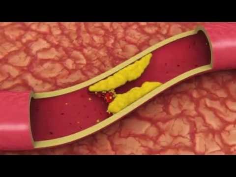 Keshilla per te ulur KOLESTEROLIN