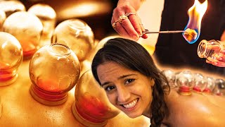 I Tried FIRE Cupping for the First Time (extreme massage)