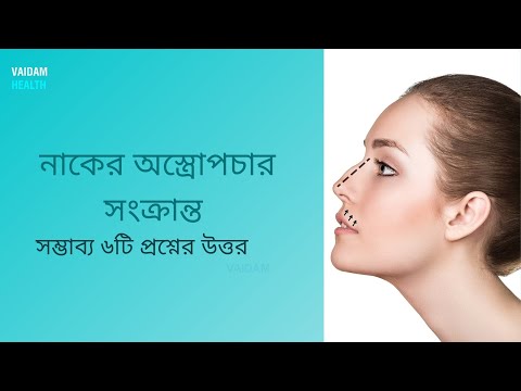 রাইনোপ্লাস্টি- ৬ টি প্রায়শই জিজ্ঞাসিত প্রশ্ন