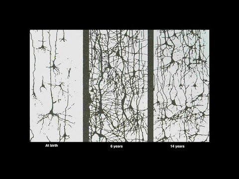 The Amazing Teen Brain