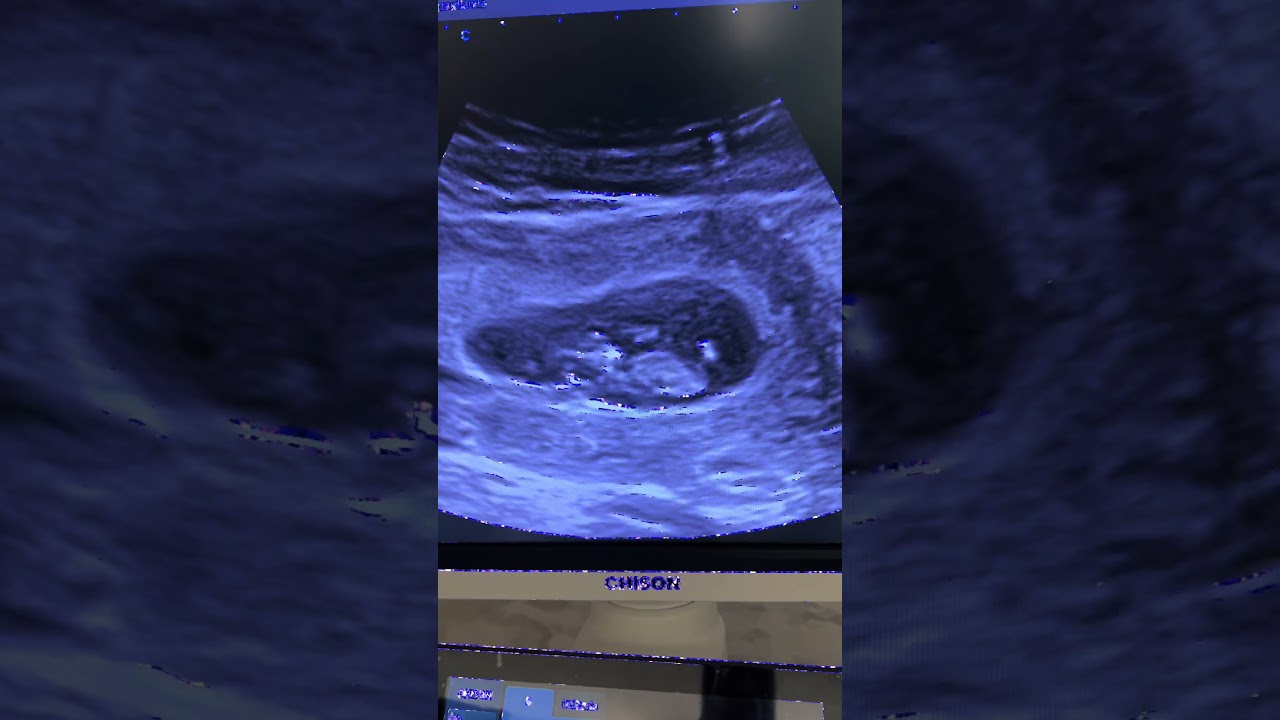 Atieel Flores Morales-11