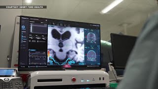 New brain treatment at Henry Ford Hospital can treat tremors in real time