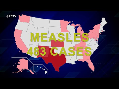 Palm Beach TV: Measles outbreak and Glazer Hall sneak peak - April 3, 2025