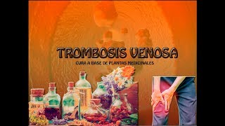 TROMBOSIS!! Prevención y tratamiento con remedios 100% naturales