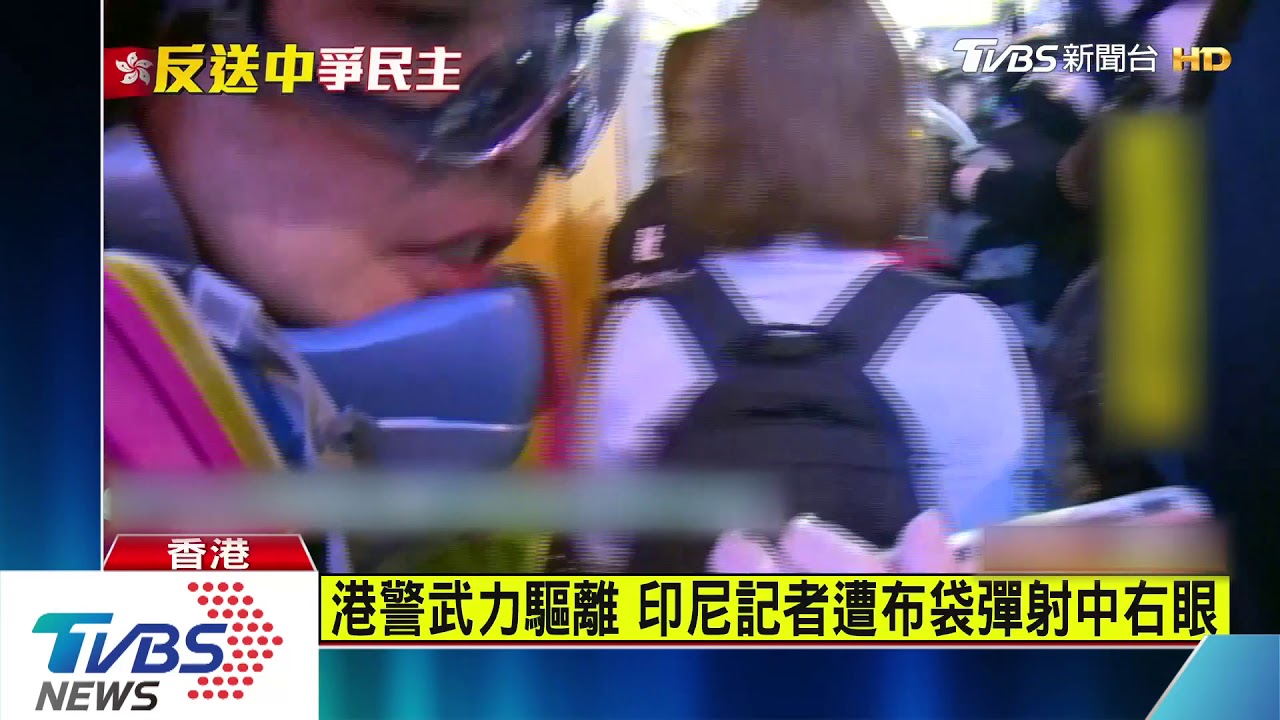 港警武力驅離　印尼記者遭布袋彈射中右眼