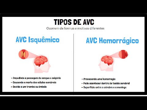 O que é AVC, AVE, Derrame Cerebral | Tratamento, Diagnóstico, Prevenção