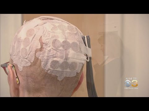 Electric Skull Cap Helping Brain Cancer Patients Live Longer, Doctors say