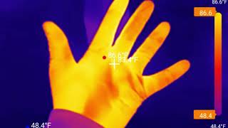 TOPDON TC003 Infrared Thermal Camera