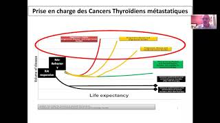 Pr SLIMANE ZERDOUD CANCER DE LA THYROIDE