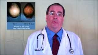 The science behind hair loss