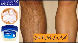 Stop Shaving! How i remove of facial, body and pubic hair permanently with Vassline & Alum