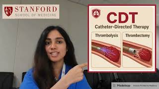 CDT for Acute PE Medeloop
