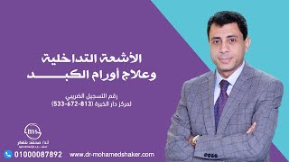 علاج اورام الكبد الجزء الثاني - لقاء أ.د محمد شاكر على قناة القاهرة والناس