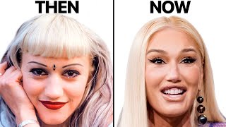 Gwen Stefani NEW FACE | Plastic Surgery Analysis