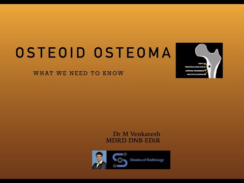Osteoid Osteoma-What we need to know