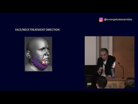 Η εφαρμογή των ραδιοσυχνοτήτων για λιποαναρρόφηση και σύγχρονη σύσφιξη σε ασθενείς άνω των 40 ετών