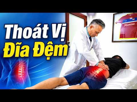 Thoát Vị Chèn Ép Thần Kinh: Khi Nào Mới Thật Sự Cần Mổ