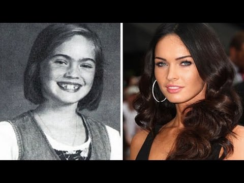 20 Celebrities Who Blossomed After Puberty