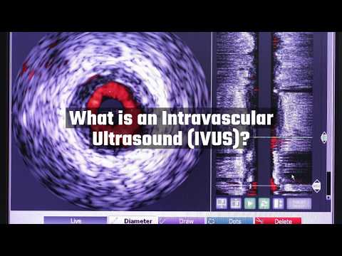 What is an Intravascular Ultrasound?