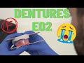 Do We Suck At Dentures ACE Diploma Journey E02