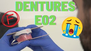 Do we suck at Dentures? | ACE diploma Journey E02