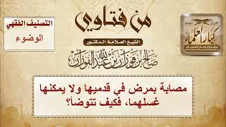 صورة 1490 - مصابة بمرض في قدميها ولا يمكنها غسلهما، فكيف تتوضأ؟ - الشيخ صالح الفوزان