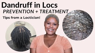 If you have dandruff and locs, watch this! | Loctician Tips