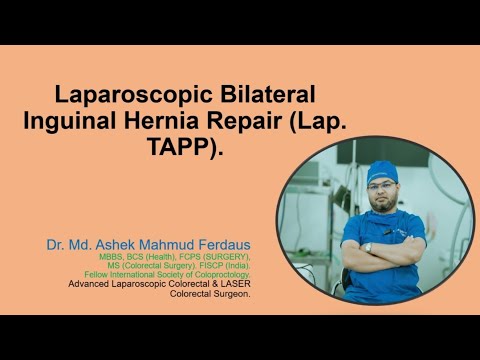 Laparoscopic bilateral inguinal hernia repair