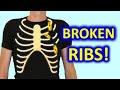 6 Do S 6 Don Ts To Recover From Broken Ribs