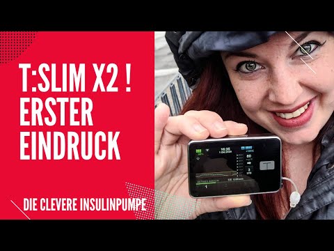 T:slim X2 Insulinpumpe - Erster Eindruck / Erstes Anlegen / Technische Einweisung