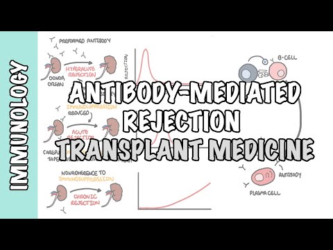 Medicina de trasplantes - rechazo mediado por anticuerpos