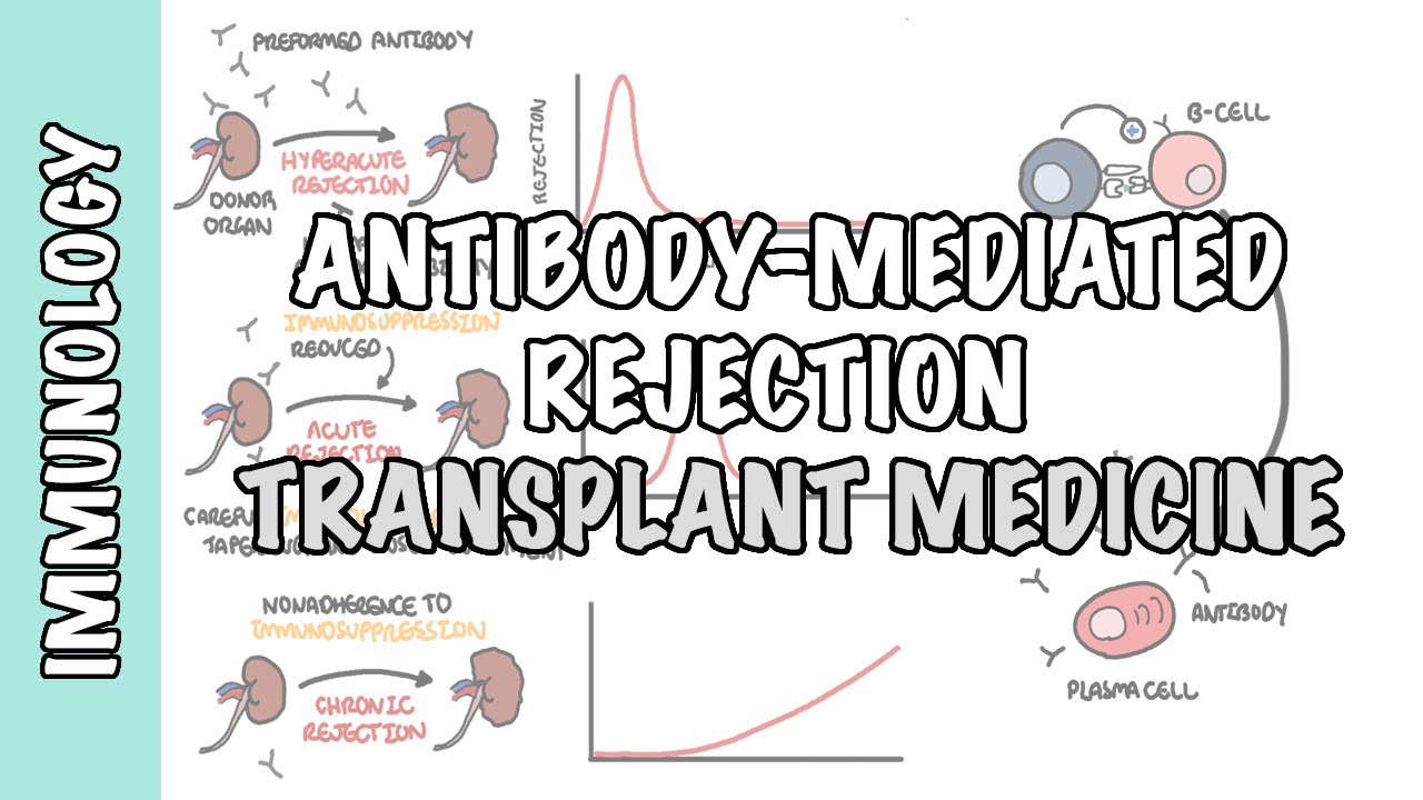 Transplant Medicine - Antibody mediated rejection