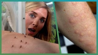 Mosquitos Suck Maddie&#39;s Blood! | Earth Unplugged