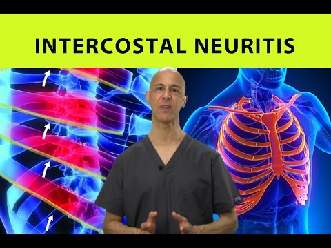 Intercostal Neuritis Relief (Mid Back Pain, Rib & Chest Pain) - Dr Mandell