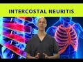 Intercostal Neuritis Relief Mid Back Pain Rib Chest Pain Dr Mandell