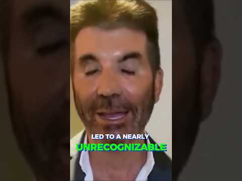The Tragic Plastic Surgery of Simon Cowell