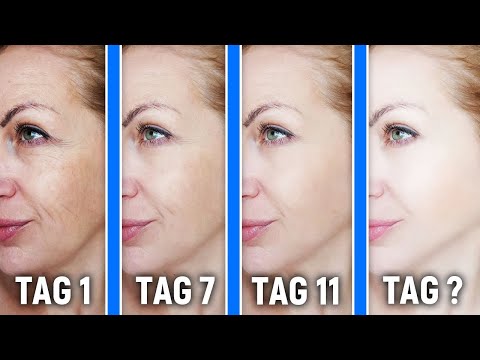 Pigment-Flecken, Falten und co für immer loswerden!