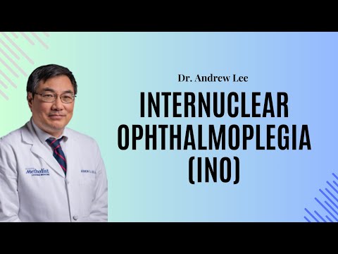 Internuclear Ophthalmoplegia (INO)