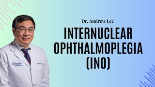Internuclear Ophthalmoplegia (INO)