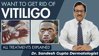 White Patches On Skin? || Treatment Of Vitiligo ||Get Instant Rid Of Vitiligo By Dr Sandesh Gupta