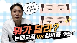 눈매교정 vs 쌍꺼풀👀, 헷갈리면 안 되는 차이가 있다고요?! #눈매교정 #쌍꺼풀수술 #쌍수