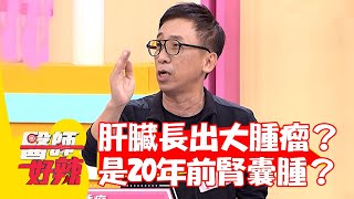 苦苓肝臟長出超大腫瘤？竟是20年前發現的腎囊腫？【#醫師好辣】20220805 part3 EP1388 苦 苓  鄭丞傑