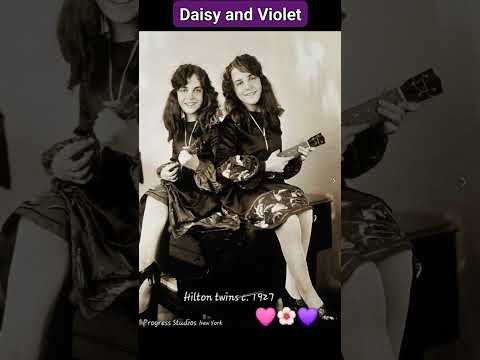 FREAKS, Chained For Life, Bound By Flesh #Conjoinedtwins #Burlesque stars-Daisy&Violet💫