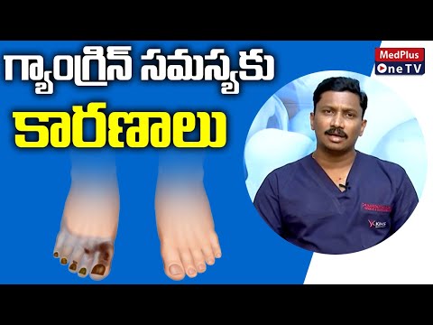 Gangrene : Gangrene Symptoms and Treatment | Dr.Narendranadh Meda | @MedPlusONETV