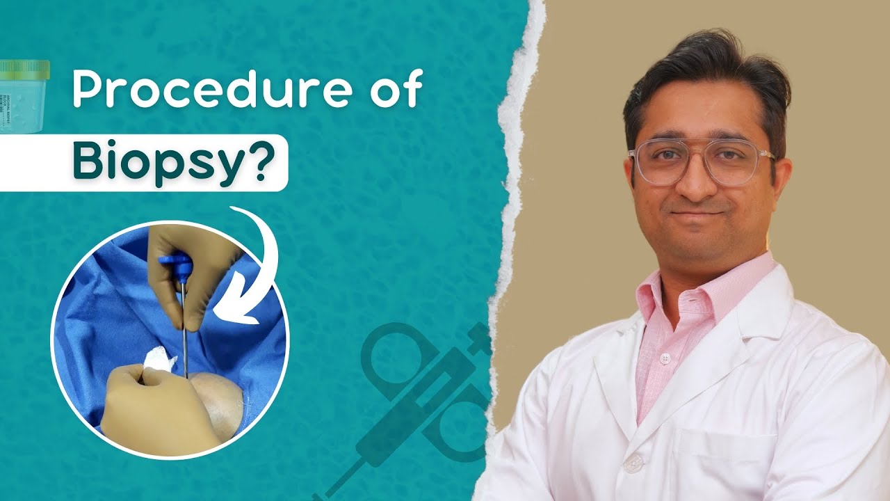 Procedure of Bone Biopsy Explained