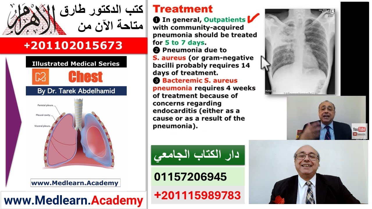 Pneumonia (Extra Points) [C]  #cme #internal_medicine #medical #usmle #محاضرات_باطنة