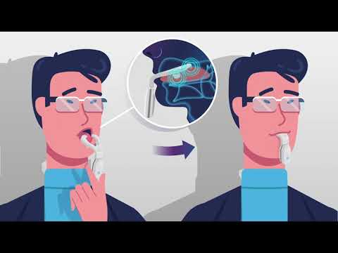 eXciteOSA Quick Start Guide - UK