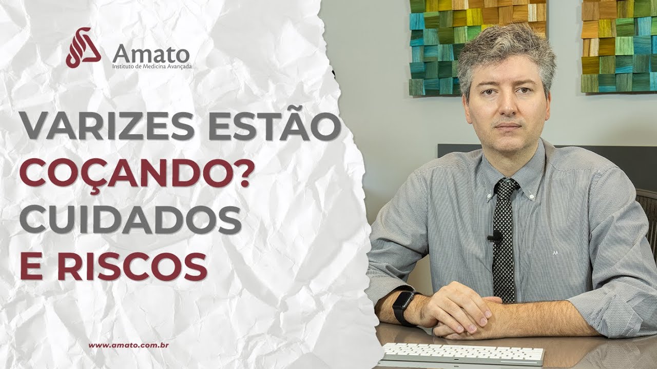 Varizes Estão Coçando Cuidados e Riscos