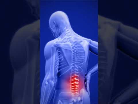 Lumbago explained in 1 minute