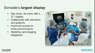 Sonosite LX: Your Procedural Partner